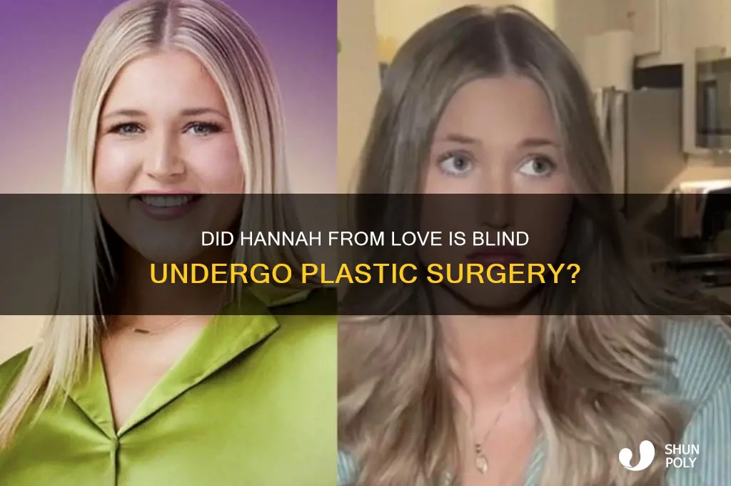 did hannah on love is blind have plastic surgery