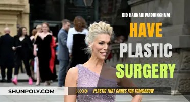 Hannah Waddingham's Transformation: Plastic Surgery Speculations Explored