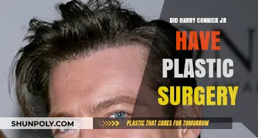 Harry Connick Jr's Transformation: Plastic Surgery Speculations and Facts