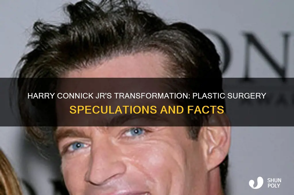 did harry connick jr have plastic surgery