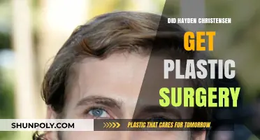 Hayden Christensen Plastic Surgery Rumors: Fact or Fiction?