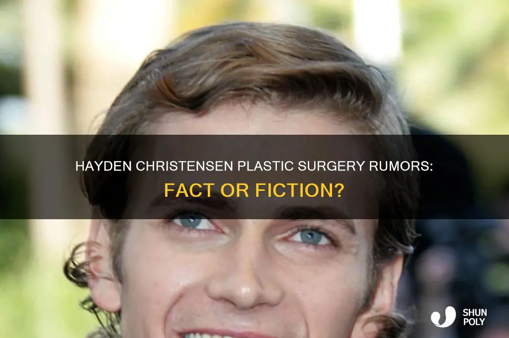did hayden christensen get plastic surgery