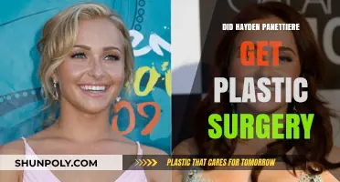 Hayden Panettiere Plastic Surgery: Fact-Checking the Transformation Rumors