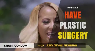 Hazel E's Transformation: Plastic Surgery Speculations and Truths Revealed