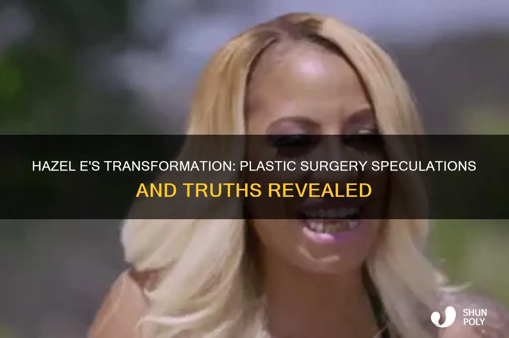 did hazel e have plastic surgery