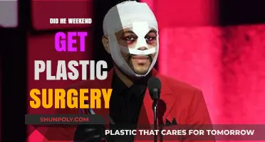 Did The Weeknd Undergo Plastic Surgery? Unraveling the Transformation Speculations