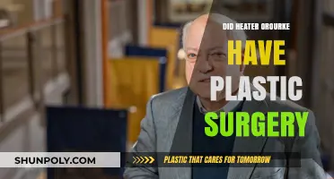 Did Heater O'Rourke Undergo Plastic Surgery? Uncovering the Truth