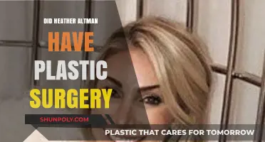 Heather Altman Plastic Surgery: Fact-Checking the Rumors and Speculations