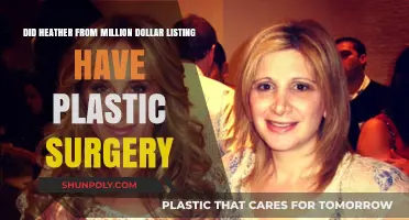 Heather from Million Dollar Listing: Plastic Surgery Speculations Explored