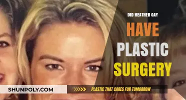 Heather Gay's Transformation: Plastic Surgery Speculations and Truths Revealed