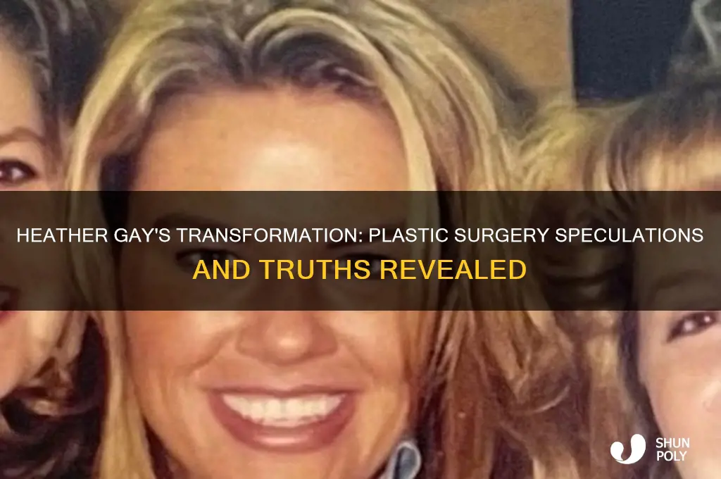 did heather gay have plastic surgery