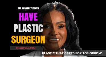 Did Heavenly Kimes Undergo Plastic Surgery? Unveiling the Truth