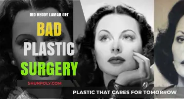 Hedy Lamarr's Plastic Surgery: Did It Go Terribly Wrong?