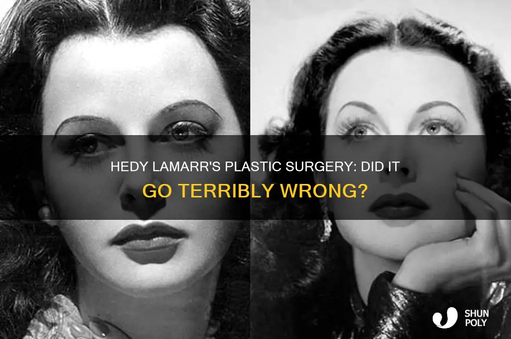 did heddy lamar get bad plastic surgery