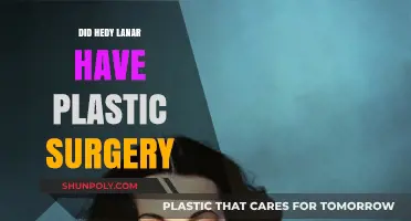 Hedy Lamarr's Beauty Secrets: Plastic Surgery Speculations Explored