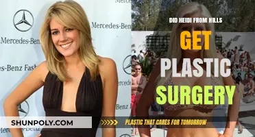 Heidi from The Hills: Plastic Surgery Rumors Explored