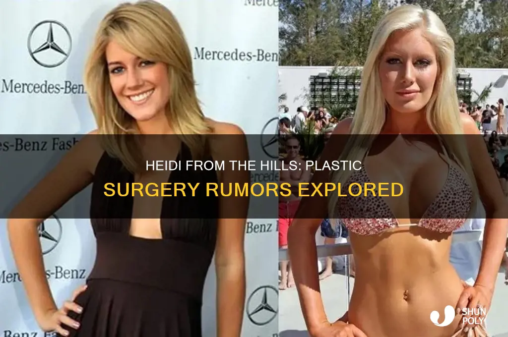 did heidi from hills get plastic surgery