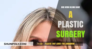 Heidi Klum's Transformation: Plastic Surgery Rumors Explored and Debunked