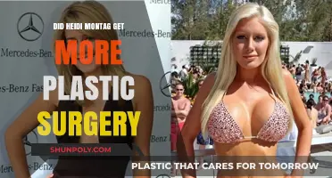 Heidi Montag's Latest Transformation: More Plastic Surgery Rumors Explored