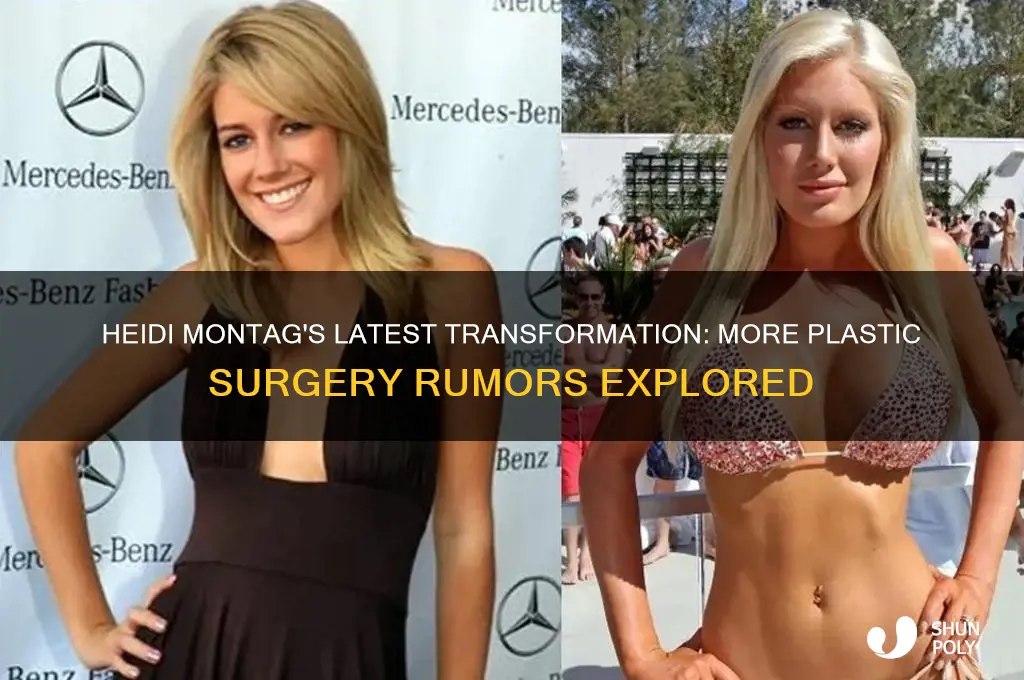 did heidi montag get more plastic surgery