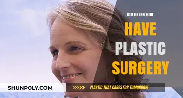 Helen Hunt Plastic Surgery Speculations: Fact or Fiction?