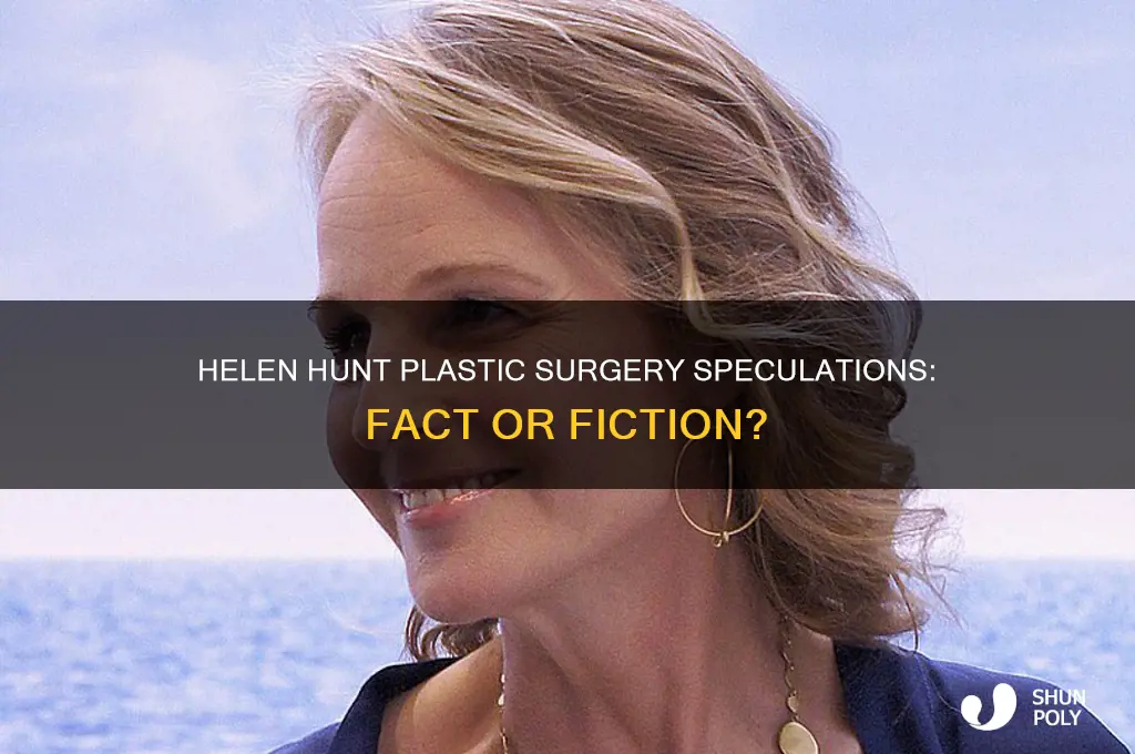 did helen hint have plastic surgery