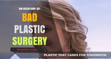 Helen Hunt's Plastic Surgery: Did It Go Wrong?