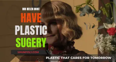 Helen Hunt's Plastic Surgery: Fact or Fiction?