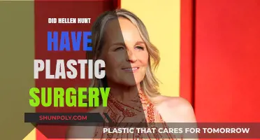 Helen Hunt Plastic Surgery: Fact-Checking the Rumors and Speculations