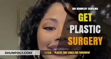 Hennessy Carolina's Transformation: Plastic Surgery Rumors Explored