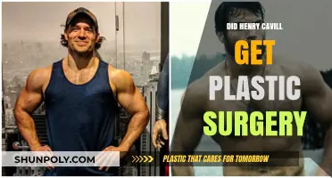 Henry Cavill's Transformation: Plastic Surgery Rumors Explored and Debunked