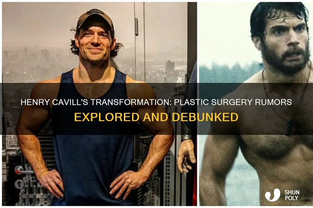 did henry cavill get plastic surgery