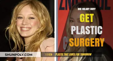 Hilary Duff's Transformation: Plastic Surgery Rumors Explored
