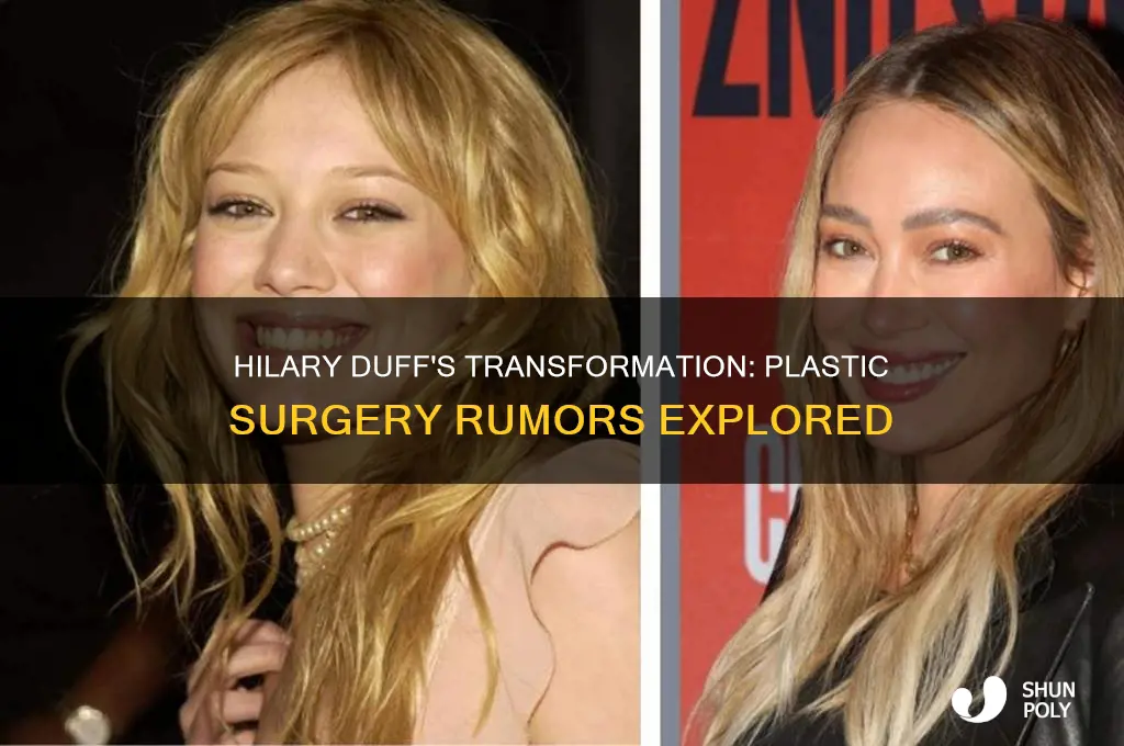 did hilary duff get plastic surgery
