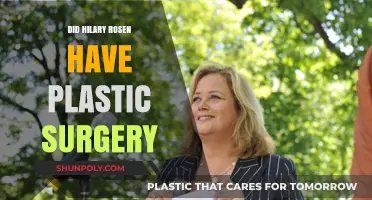 Did Hilary Rosen Undergo Plastic Surgery? Examining the Speculations