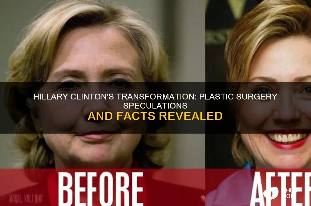 did hillary clinton get plastic surgery