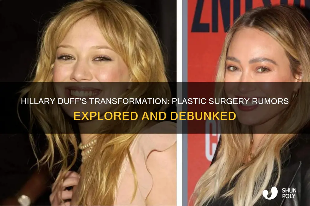 did hillary duff get plastic surgery