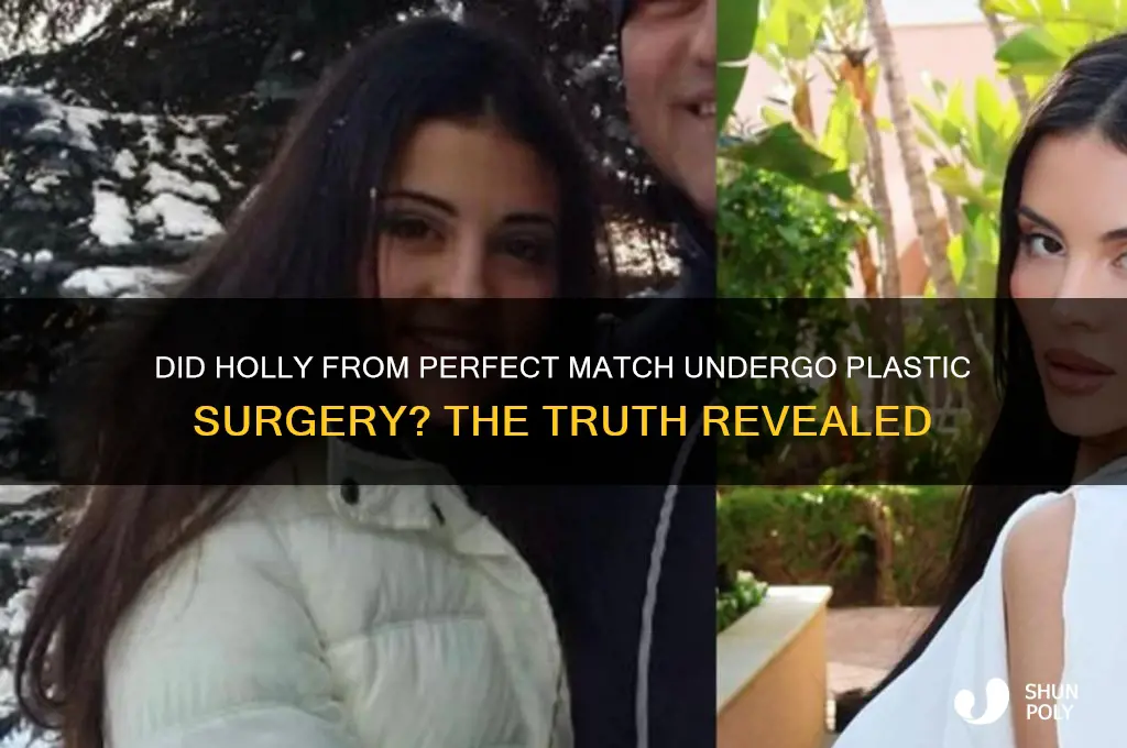 did holly from perfect match get plastic surgery