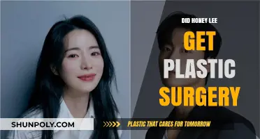 Honey Lee's Transformation: Plastic Surgery Rumors and the Truth Behind Them