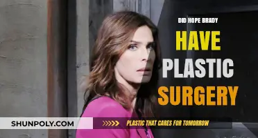 Hope Brady's Transformation: Plastic Surgery Speculations and Truths Revealed