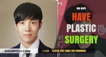 Did Hope Undergo Plastic Surgery? Unveiling the Truth Behind the Rumors