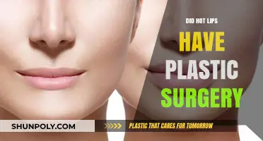 Hot Lips' Transformation: Plastic Surgery Rumors and Reality Revealed