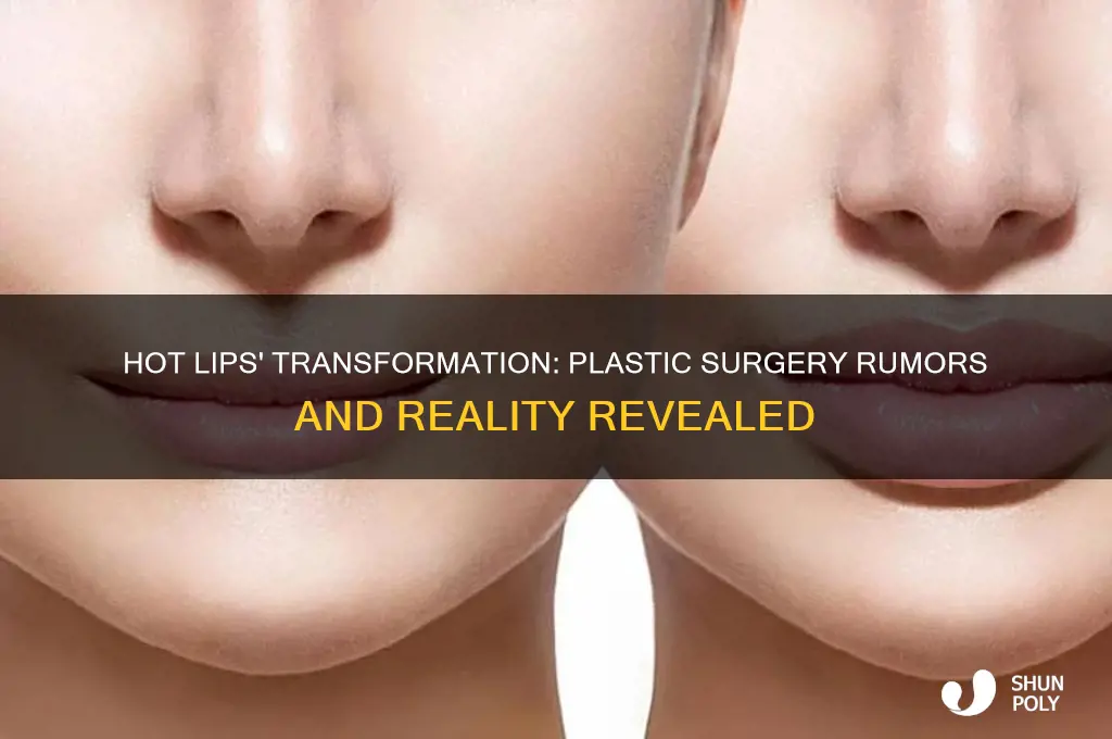 did hot lips have plastic surgery