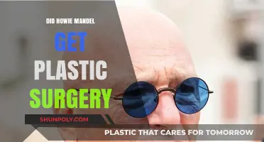 Howie Mandel's Transformation: Plastic Surgery Rumors Explored