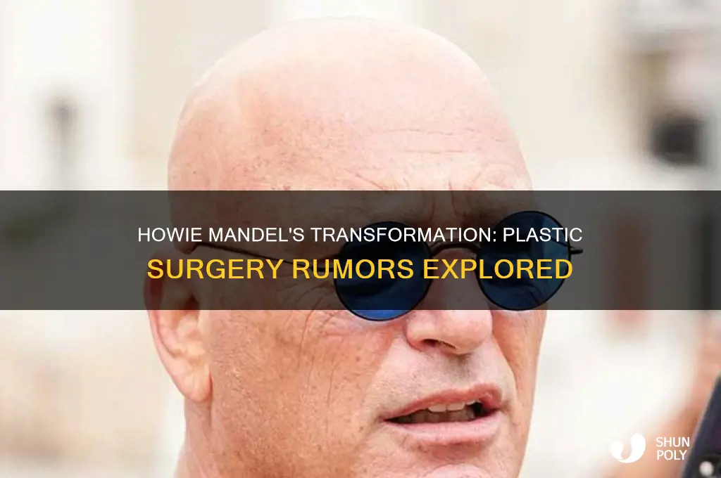 did howie mandel get plastic surgery