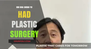 Hua Cheng Yu's Transformation: Plastic Surgery Rumors Explored