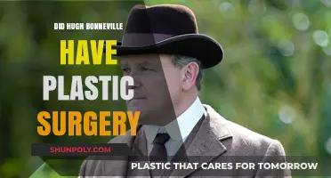 Hugh Bonneville's Transformation: Plastic Surgery Rumors Explored