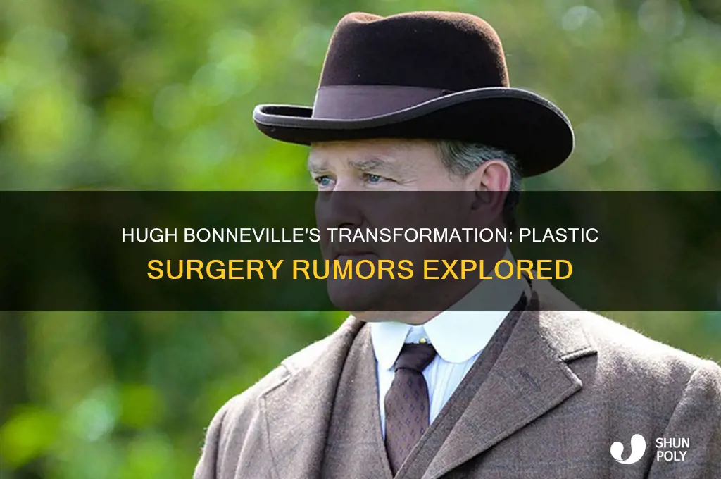 did hugh bonneville have plastic surgery