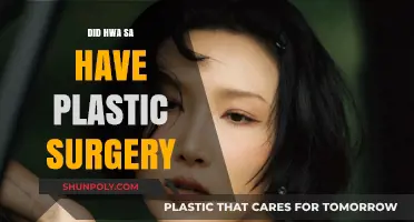 Hwa Sa's Transformation: Plastic Surgery Speculations and Truths Revealed