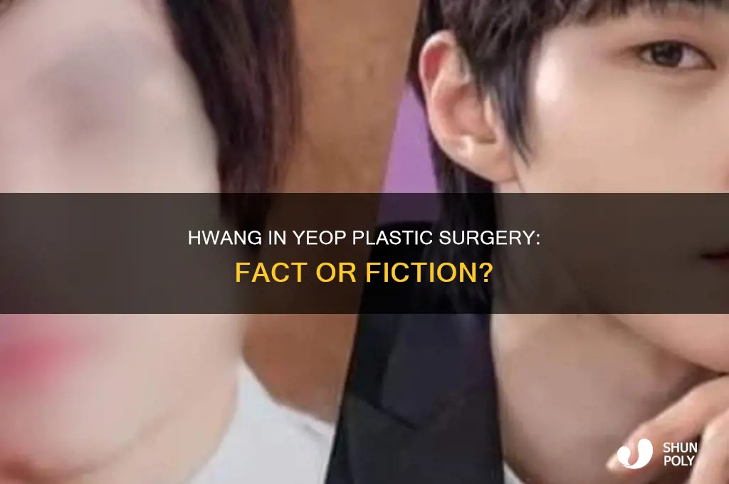 did hwang in yeop do plastic surgery